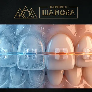 Курс лечения на брекет-системе стандартный